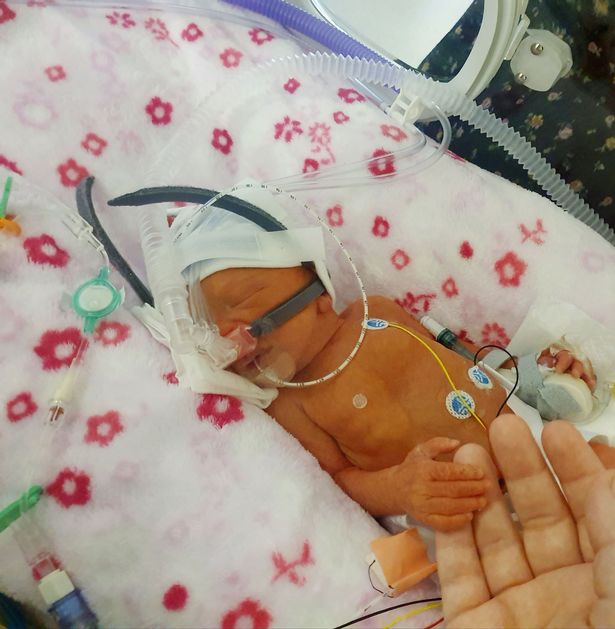 英孕妇怀孕不够4月羊水即破，本欲办葬礼，最终奇迹产子