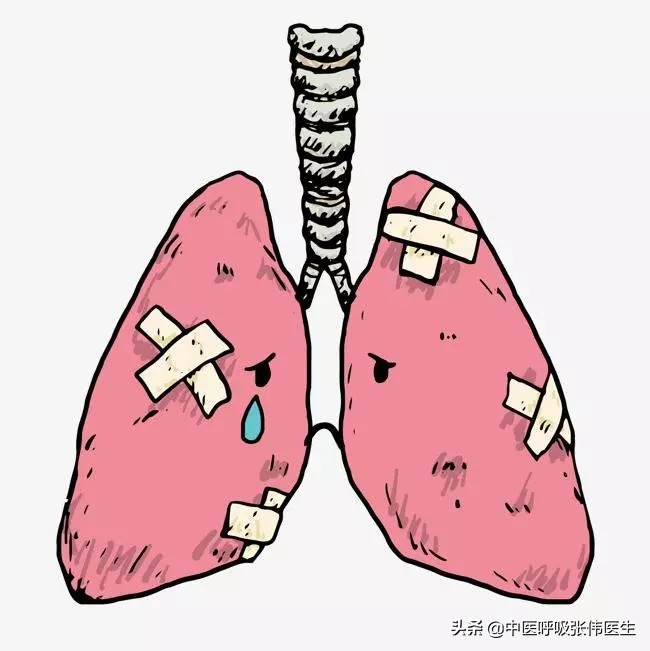 原发性肺类癌的诊疗进展