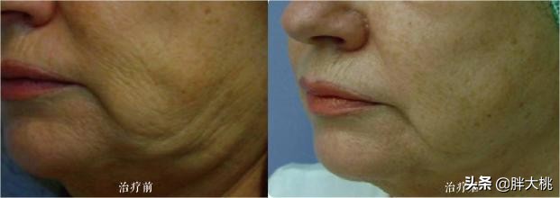 皮肤问题特别复杂怎么改善,皮肤敏感脸皮薄怎么办