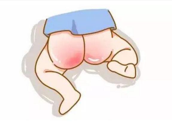 宝宝得了尿布疹怎么解决,宝宝得了尿布疹怎么办