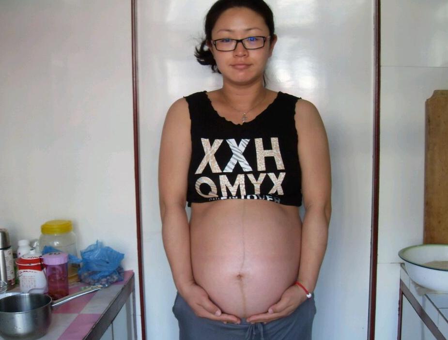 不管是顺还是剖，产后3个部位普遍会变宽，生过孩子终究不一样了