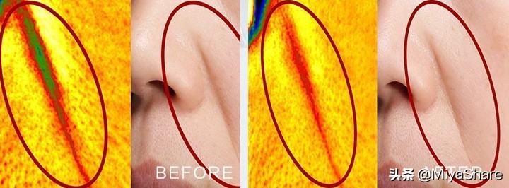 雅顿啵啵胶适合什么皮肤,雅顿啵啵胶适合年龄