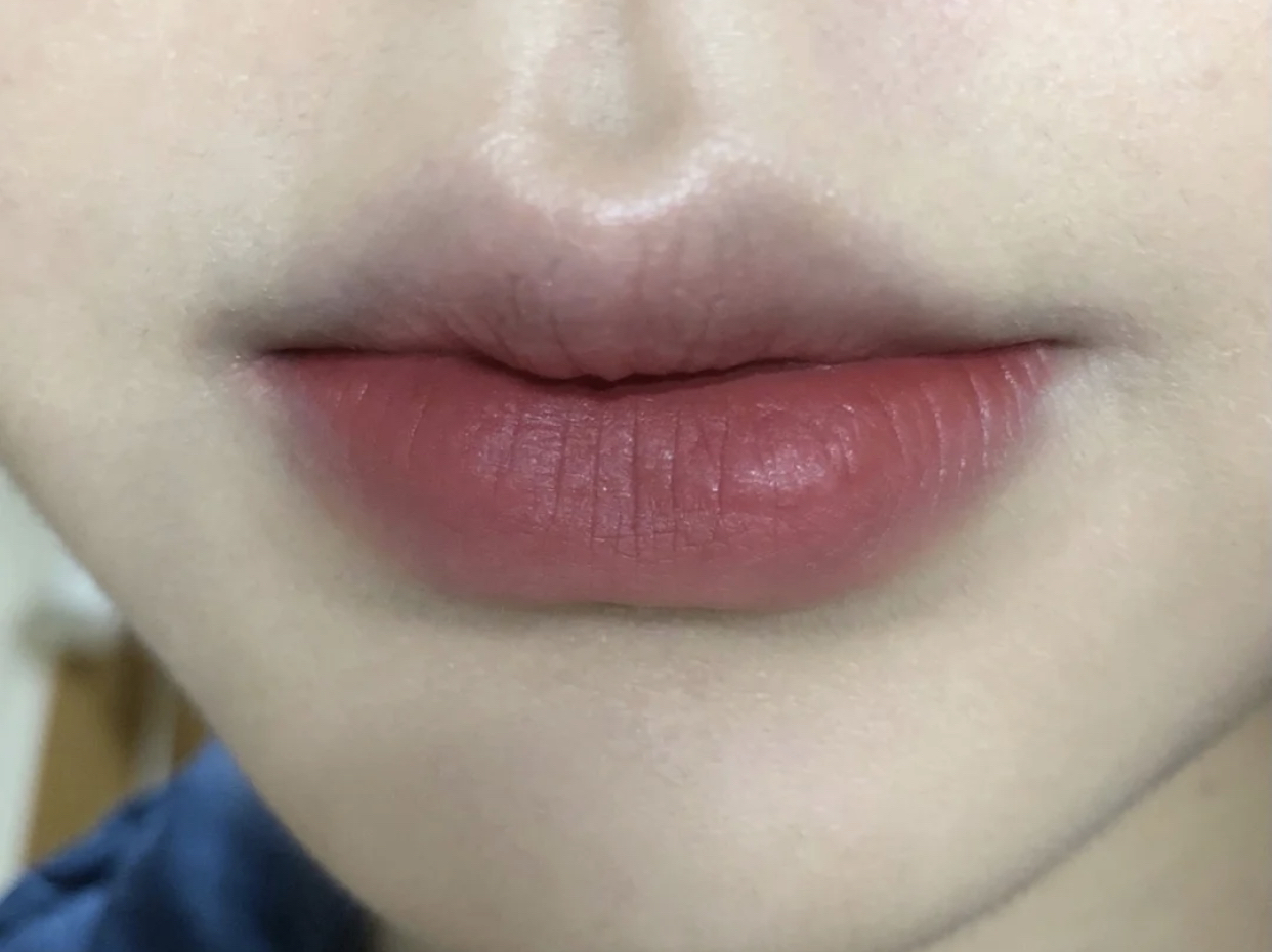 嘴唇经常又干又起皮是什么原因,嘴唇黑紫起干皮用什么