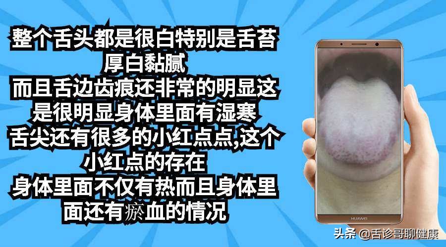 舌诊歌舌象分析与感悟,抖音舌诊哥舌象分析