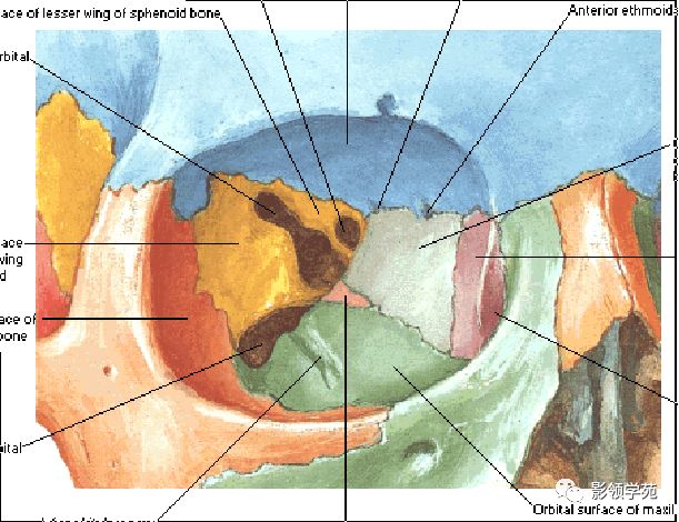 鼻骨骨折的检查方法,鼻骨骨折影像学表现