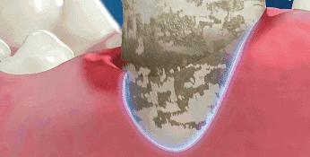 盘点全球9款真正好用的人气牙膏,牙膏界顶流炫白牙膏