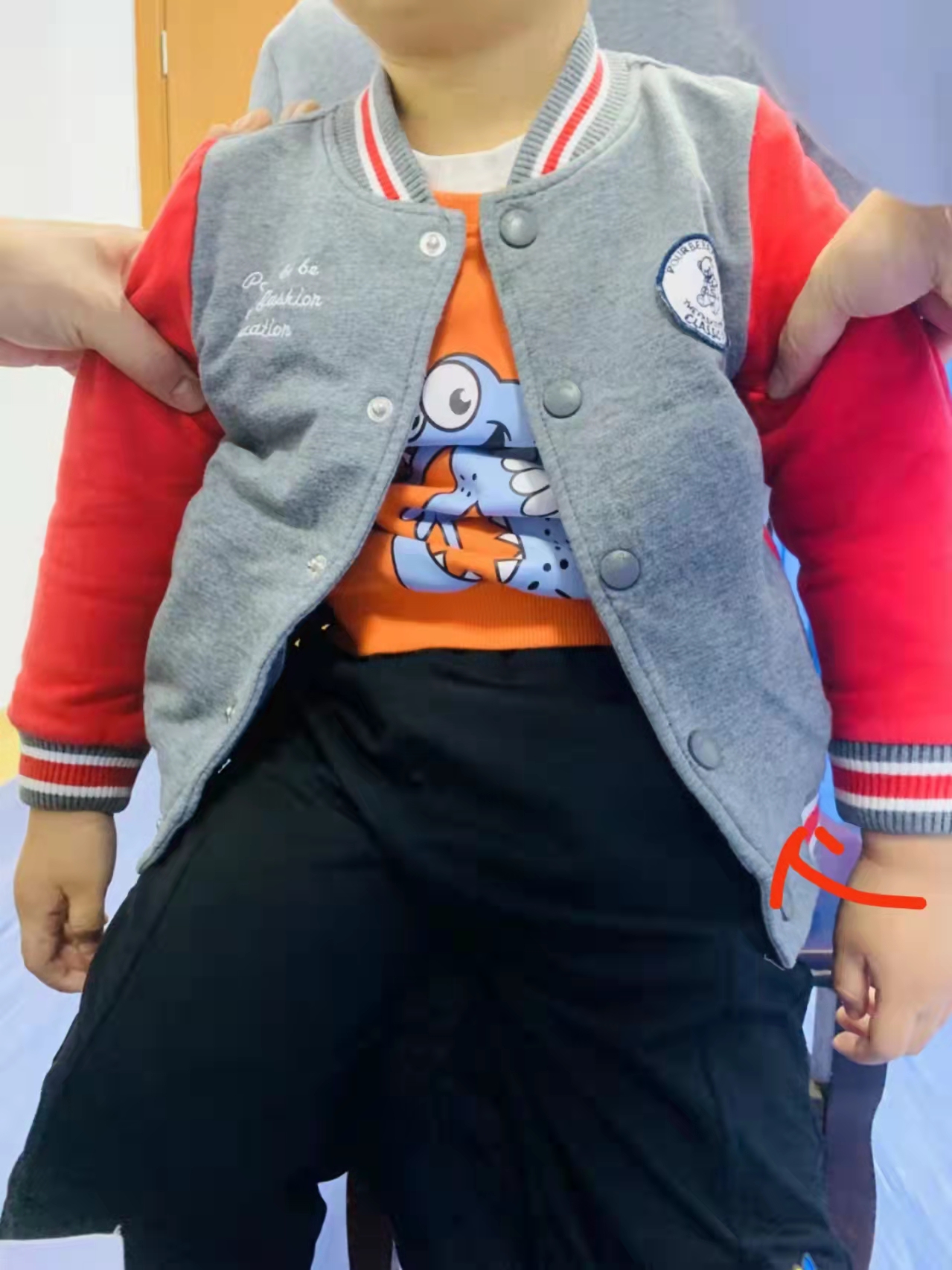 小儿桡骨小头半脱位图,桡骨小头半脱位复位最佳时间