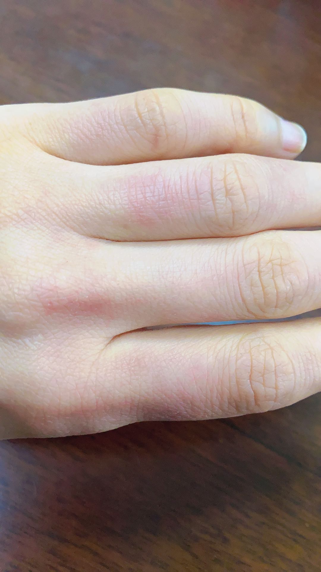 疫情期间频繁洗手的你要小心了，洗完手还要涂护手霜的更要小心了