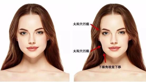 戴牙套的脸型会变丑图,戴牙套会变成巫婆脸吗