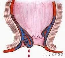 喝酒喝多了吐酒好还是不吐好,酒喝多了吐好还是不吐好