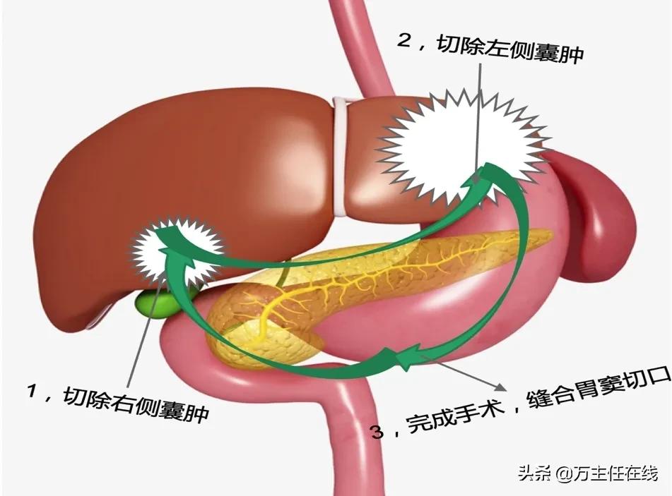 镜益求精！上海市第一人民医院万荣团队为患者带来“无痕”的美丽