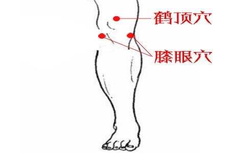 类风湿关节炎疼痛解决最好办法,常见十种关节疼痛