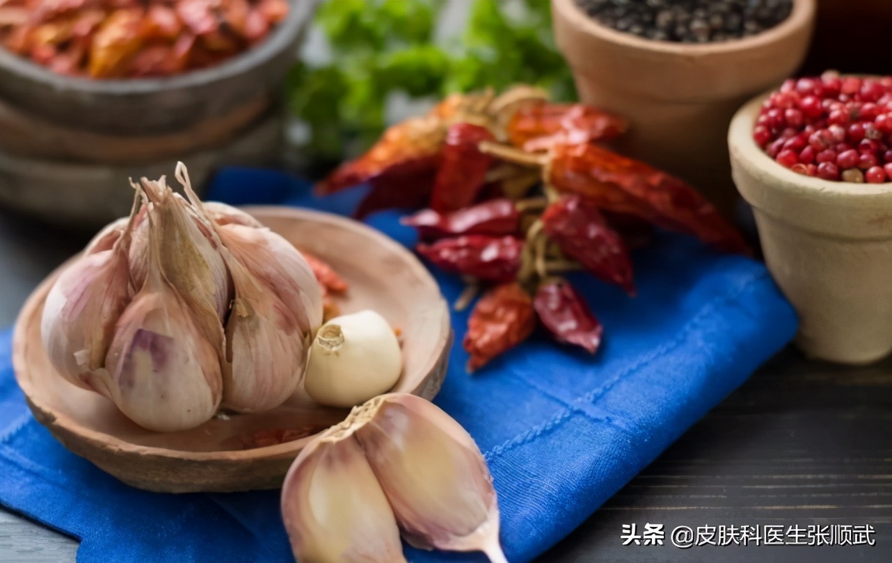 春节期间牛皮癣怎么治疗,牛皮癣冬季复发原因与调理