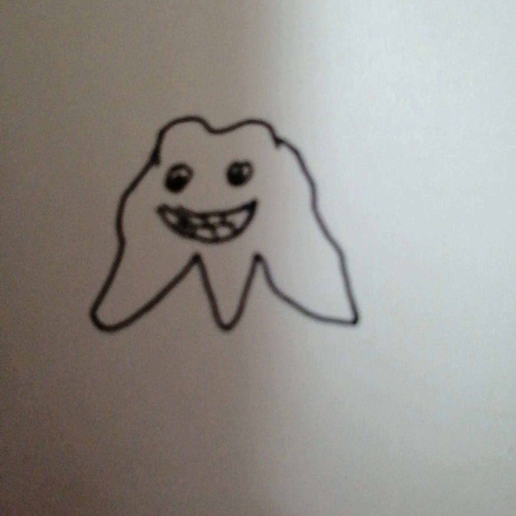 亲身经历了拔尽头牙,两颗门牙种植牙的惨痛经历