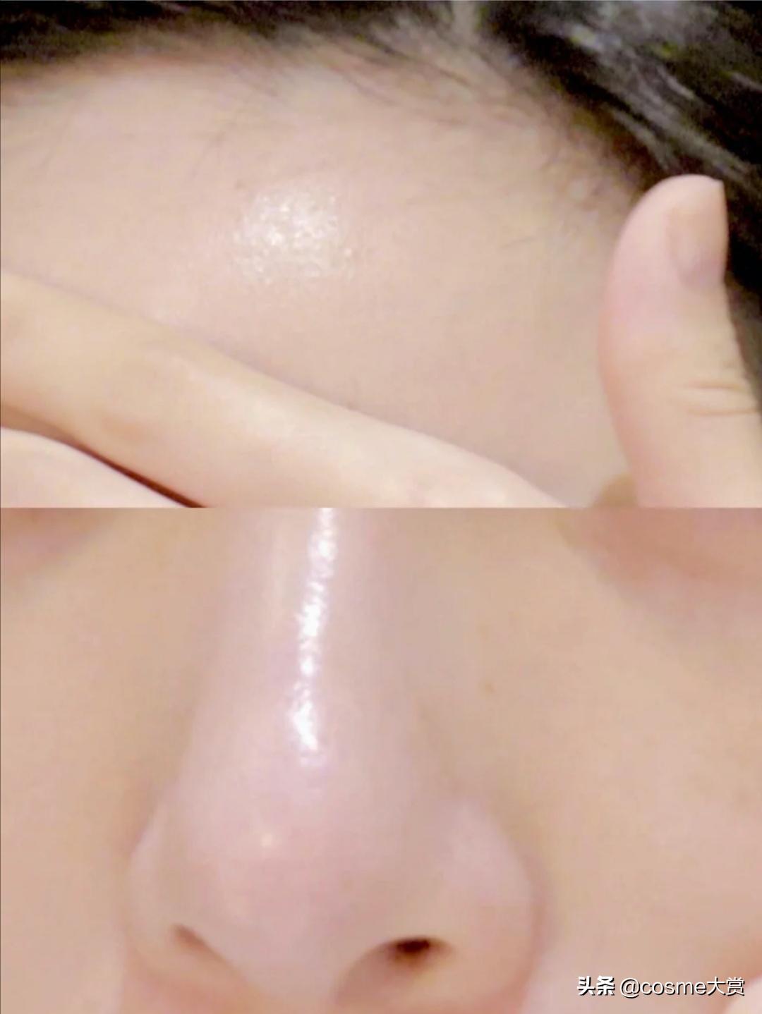脸上粉刺闭口痘印瑕疵用什么,皮肤暗黄粗糙瑕疵痘痘闭口