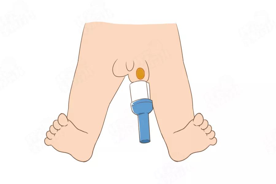 错不起！娃包皮长、丁丁小...7大*处私**异常，立马送医