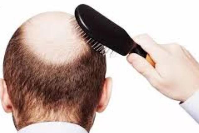 世界首家头发银行开业：冷冻头发样本，若秃顶可把细胞注射回头皮