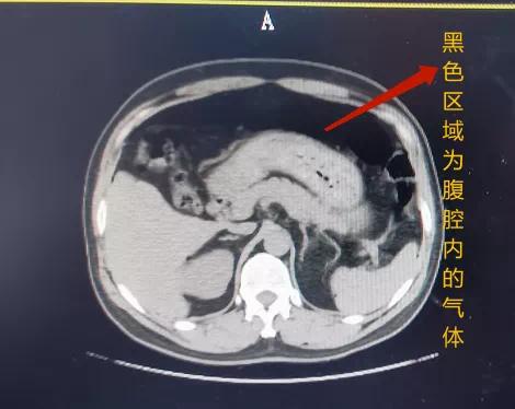 用气枪把人打伤了多久判刑,用气枪吹油对人的危害