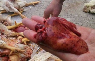 心包积液有药物预防吗,心包积液需要抗生素还是抗病毒