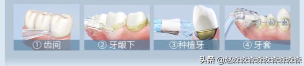 洗牙神器家用冲牙器测评,牙齿清洁神器冲牙器测评