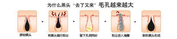 改善面部毛孔粗大方法,面部毛孔粗大如何改善男性