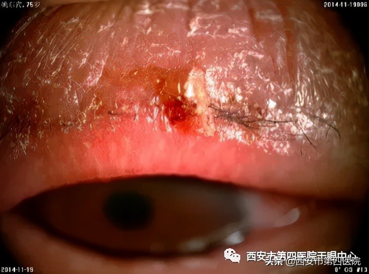 健康中国行动要应对的具体问题,健康中国行动2019-2030主要内容