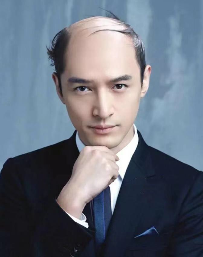 24岁头发秃得很严重,24岁头发秃顶能长出来吗