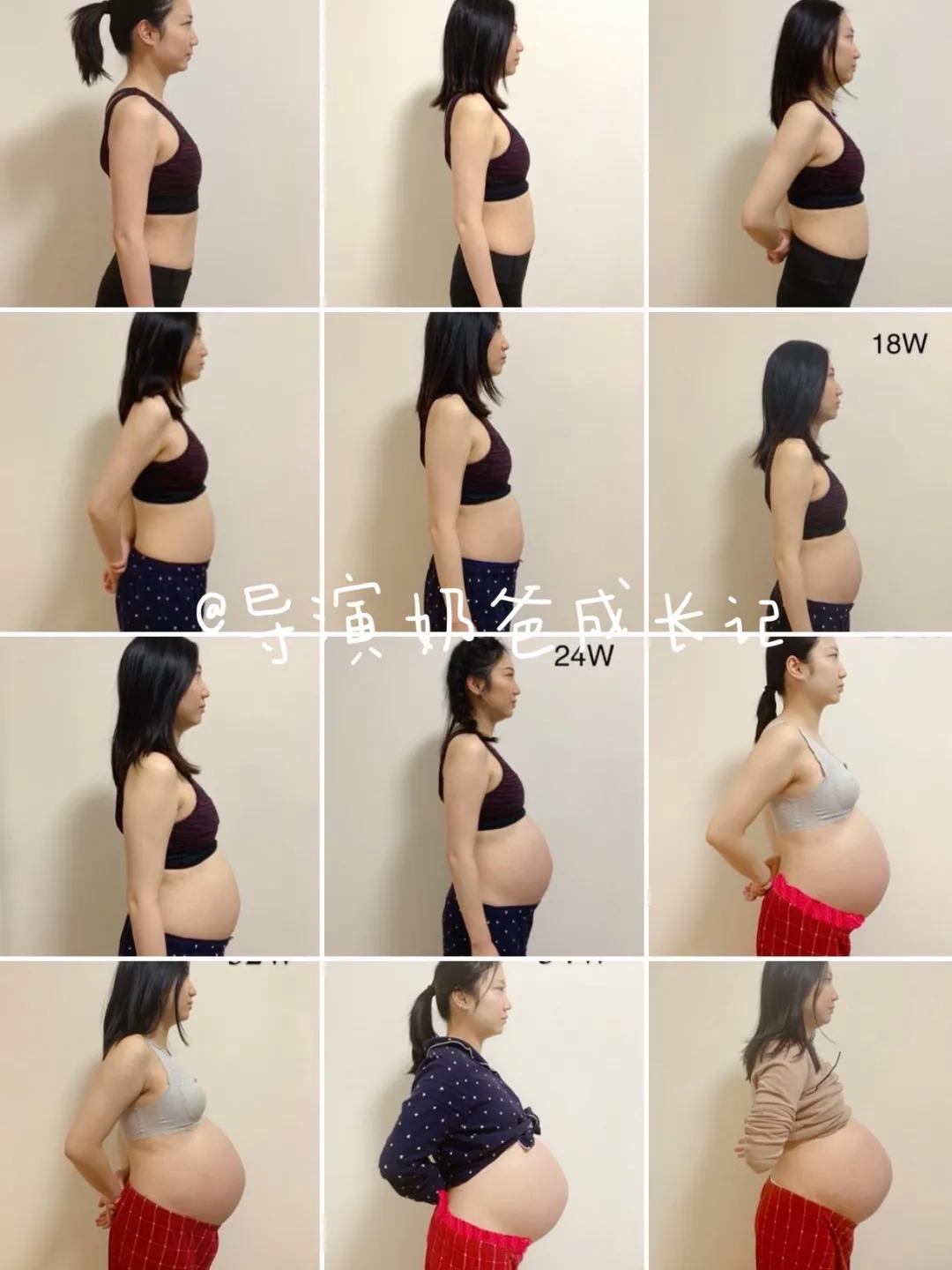 三指半到闭合，一个双胞胎妈妈的腹直肌康复之路