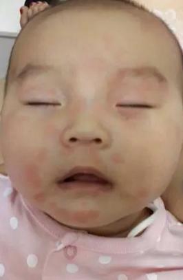 孩子没感冒突然咳嗽,9个月宝宝不感冒不咳嗽突然发烧