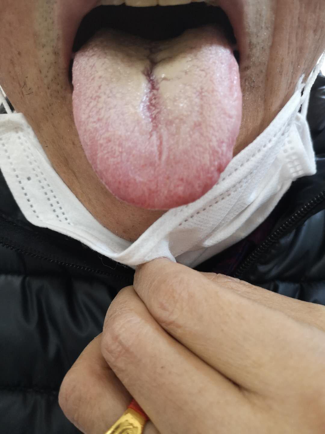 腹部胀满情志焦虑多梦易怒,腹部神经痛焦虑症