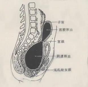简单介绍闭经的分类,关于闭经的科普