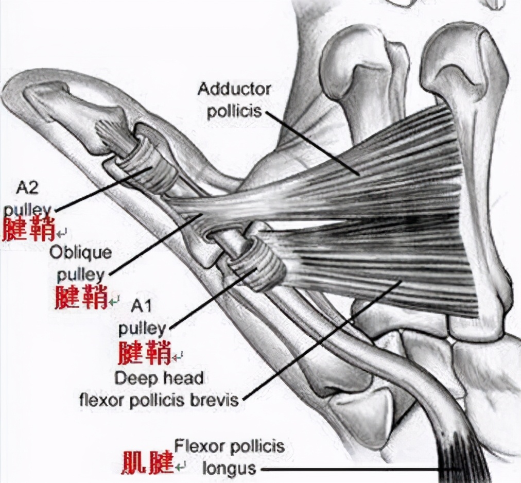 小儿狭窄性腱鞘炎应该怎么办？