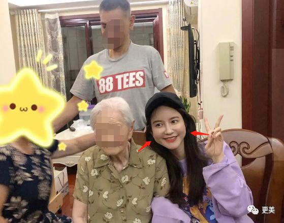 15天暴瘦20斤，却意外暴露了她填充过度的馒头脸