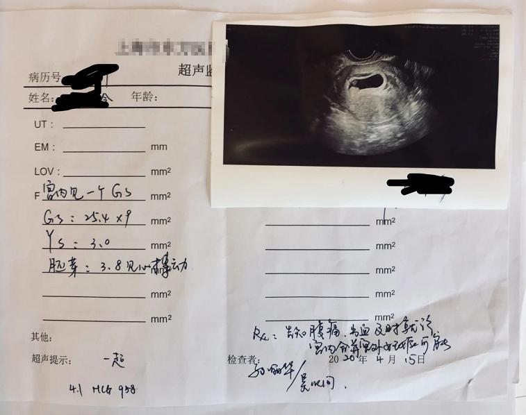 反复移植失败未着床需要做3代吗,反复移植六次不着床