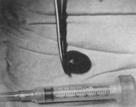 什么原因造成狗狗胆结石,狗得胆结石有什么症状