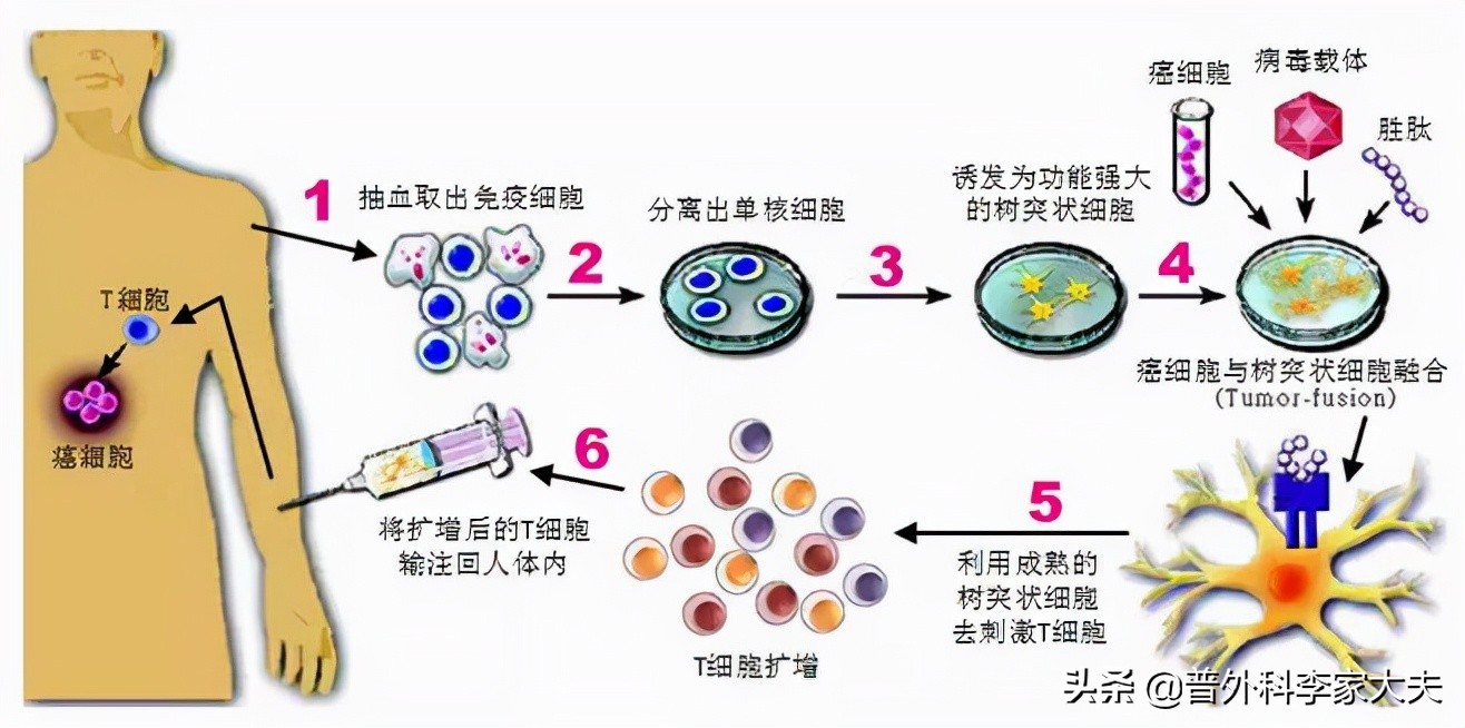 免疫治疗癌症的副作用,什么是癌症的免疫治疗方法