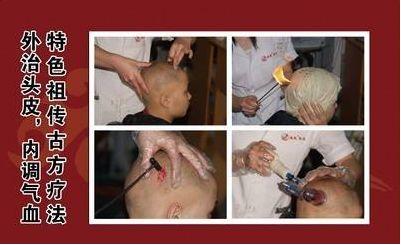 传承与弘扬苗医药,传承苗医