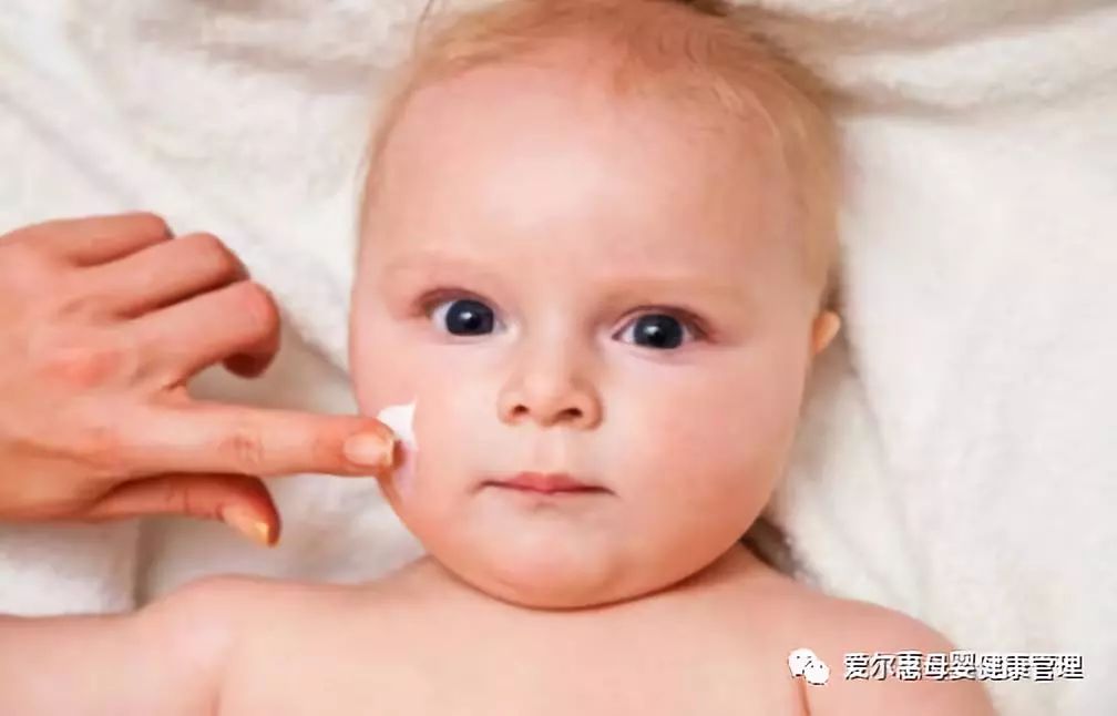 婴儿湿疹反复发作怎么办,脚上湿疹反复发作如何除根