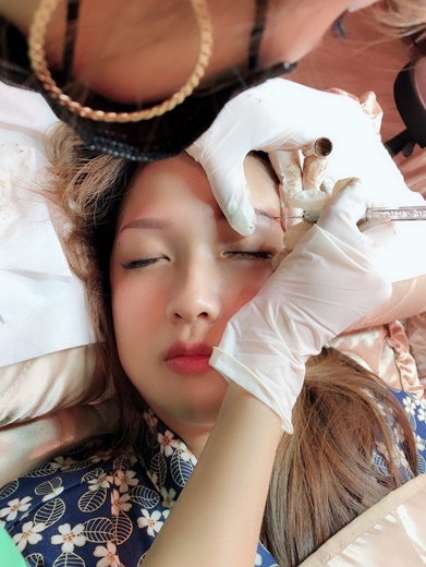 激光洗红眉的操作方法视频,红眉能激光吗