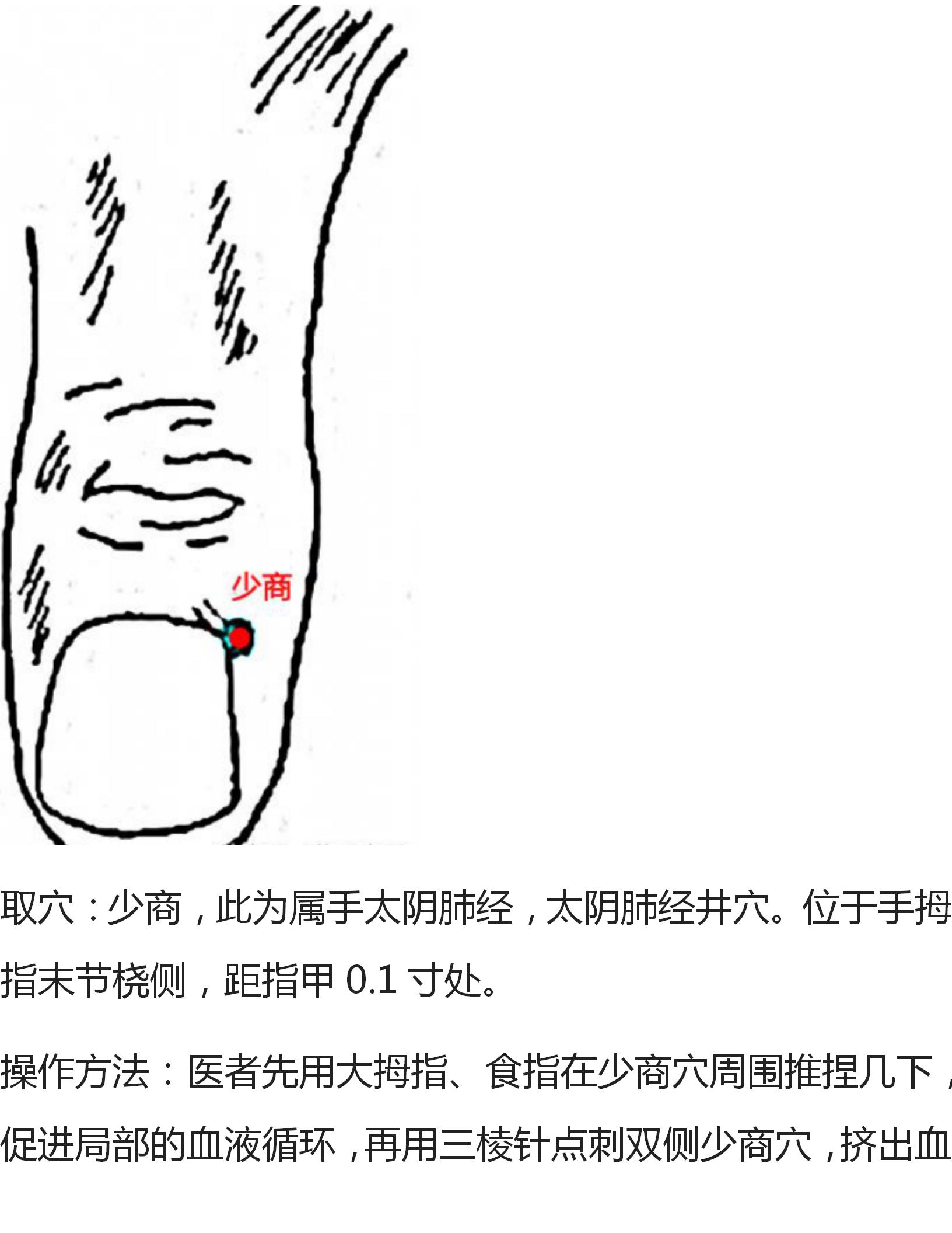 针灸治疗痛症大全,全身痛董氏奇穴针灸视频