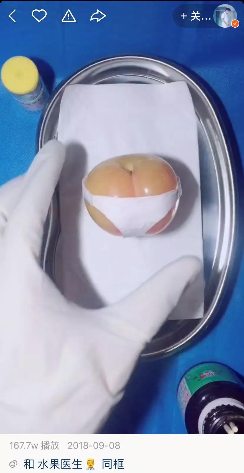 香蕉割包皮，洋葱剖腹产？这是我见过最秀的医生