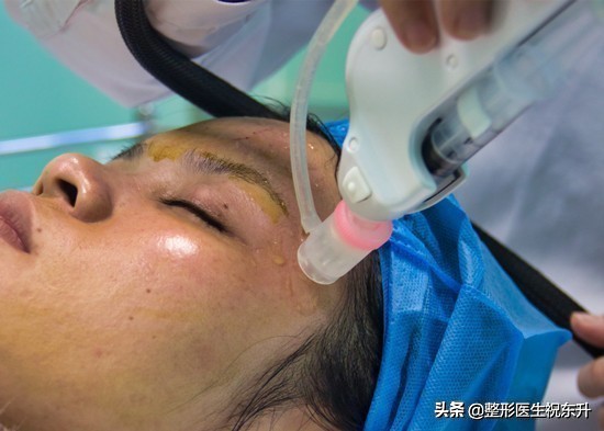 打水光针真实感受,打水光针好的评价