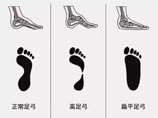 鞋不合脚穿什么鞋好,鞋不合脚要买什么