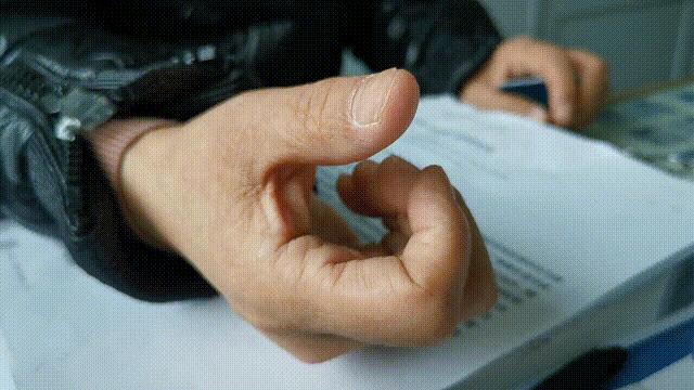 中年妇女会得腱鞘炎吗,更年期得了腱鞘炎需要治疗吗
