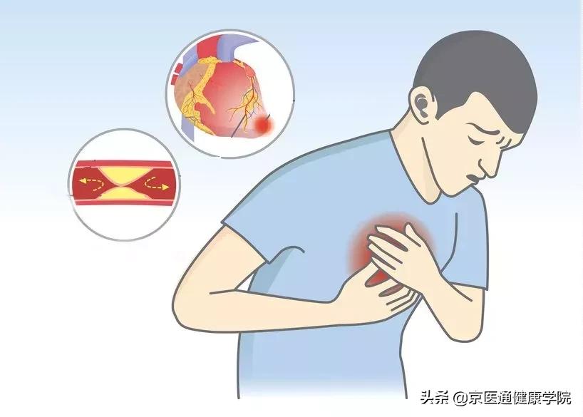 速效救心丸和硝酸甘油哪个更救命,速效救心丸和硝酸甘油保命用哪个