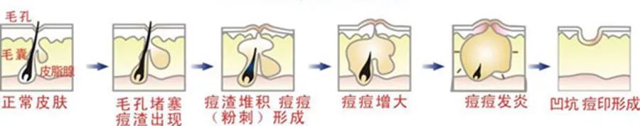 羊奶手工皂美白保湿洁面皂,肌肤之食海盐羊奶皂