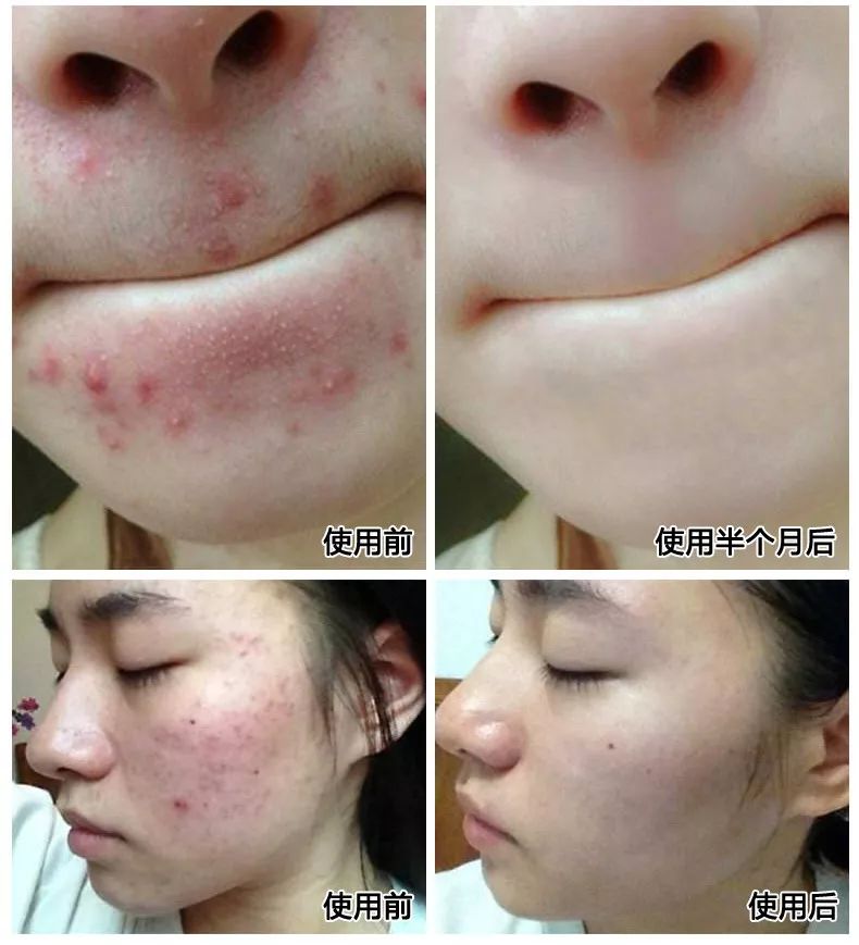 羊奶手工皂美白保湿洁面皂,肌肤之食海盐羊奶皂