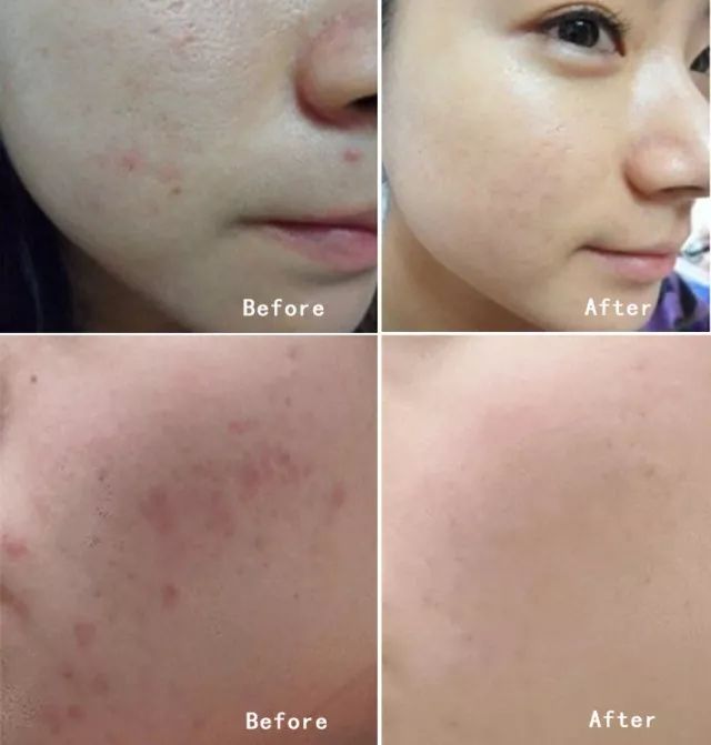 面霜家庭大容量,面霜日常护肤大容量推荐