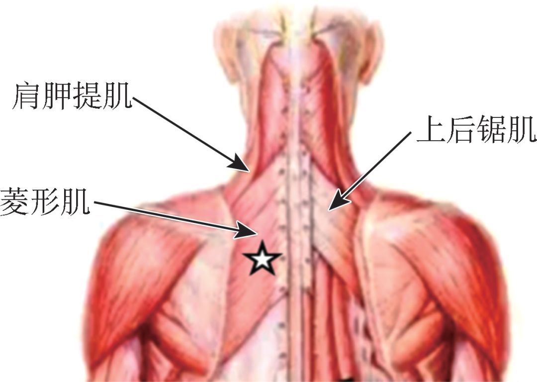 肌肉与关节疼痛的原因,关节周围肌肉疼痛