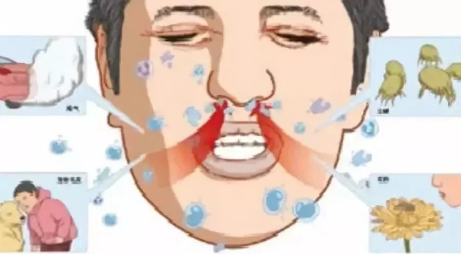 儿童鼻痒鼻塞鼻炎用什么喷剂,鼻腔缓解喷雾